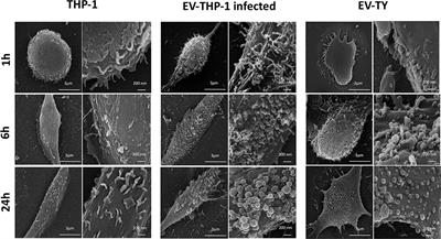 Trypanosoma cruzi-Infected Human Macrophages Shed Proinflammatory Extracellular Vesicles That Enhance Host-Cell Invasion via Toll-Like Receptor 2